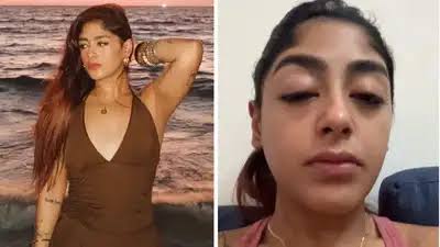 मुंबई क्लब में ‘स्प्लिट्सविला 16’ फेम प्रीत सिंह पर हमला: टूटा दांत और सूजी आंख, वीडियो शेयर कर बयां किया दर्द